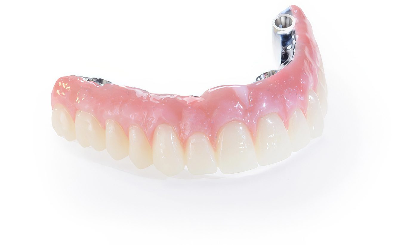 SMART 1 Composite - Burbank Dental Lab