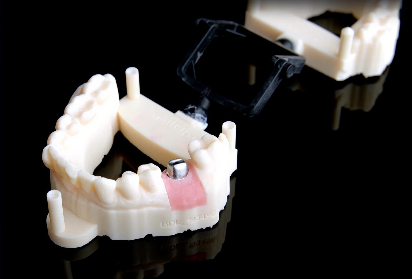 SMART 1 Implant Abutment - Burbank Dental Lab