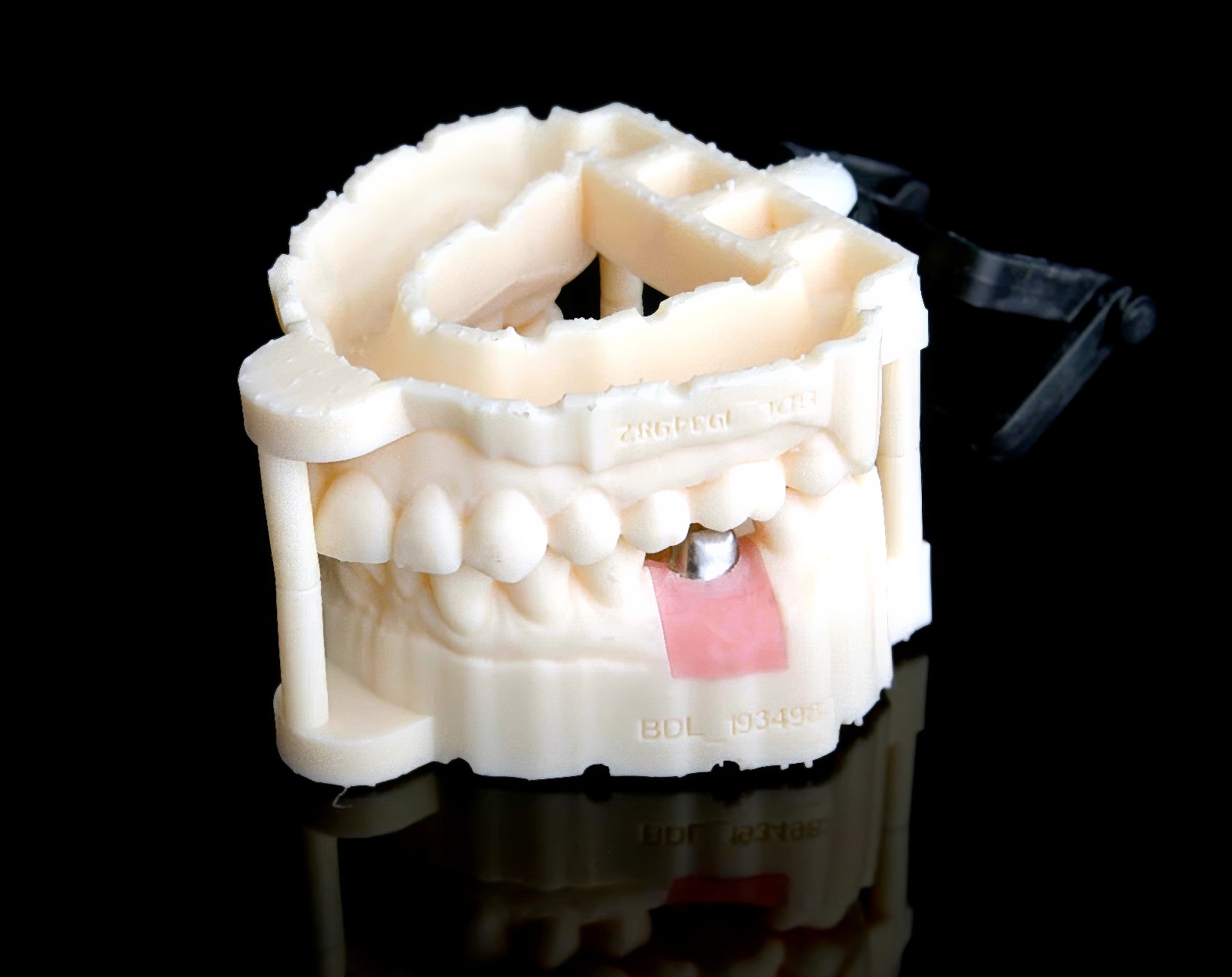 SMART 1 Implant Abutment - Burbank Dental Lab