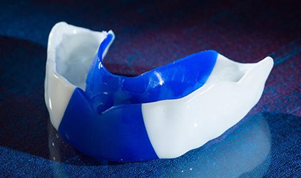 Night Guard -A product of Burbank Dental Lab - CA