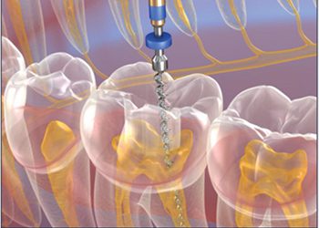 Bone & Tissue Regeneration Course - Sponsor - Burbank Dental Lab - CA