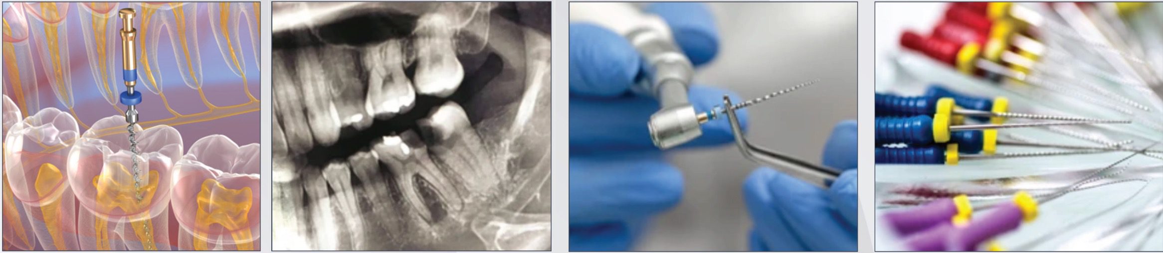 Bone & Tissue Regeneration Course - Sponsor - Burbank Dental Lab - CA