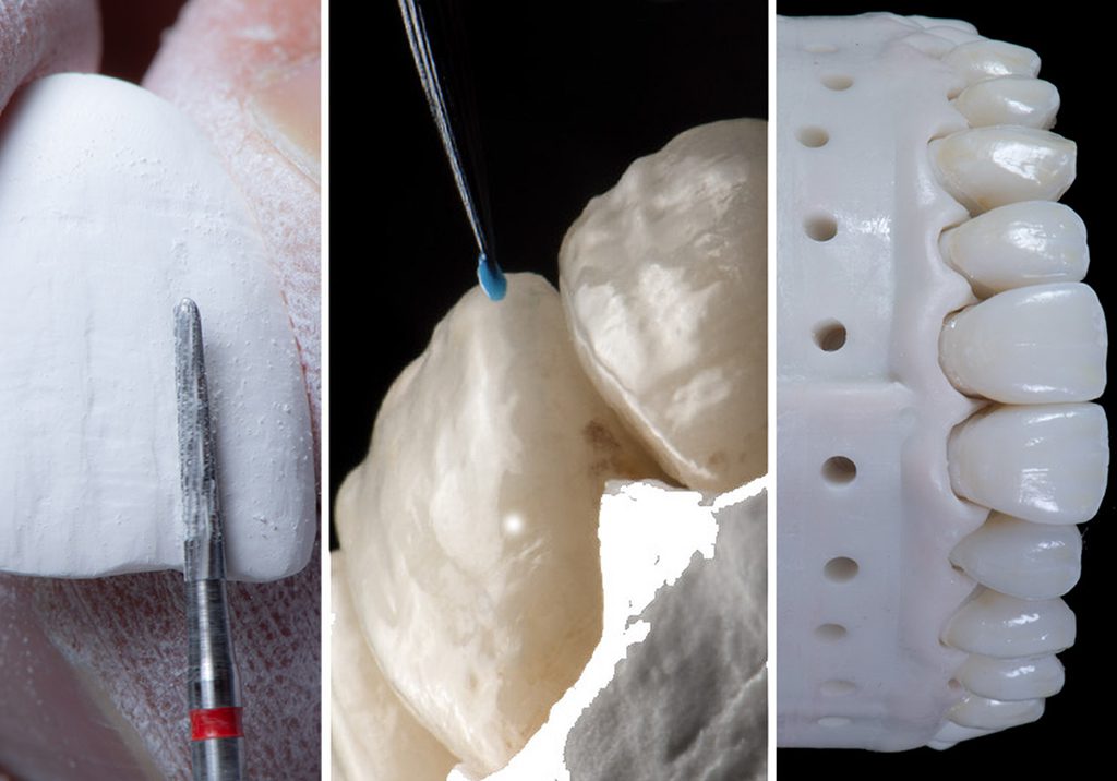 Hands-On Course taught by Dr. Ed McLaren - The Final Touch: for Monolithic Translucent Zirconia - Los Angeles, CA - April 10-11, 2026