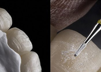 Bone & Tissue Regeneration Course - Sponsor - Burbank Dental Lab - CA