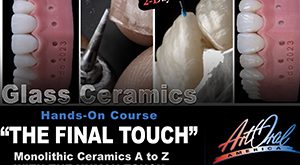 Master FirstFit In A Day - Event - March 21, 2025 - Burbank Dental Lab