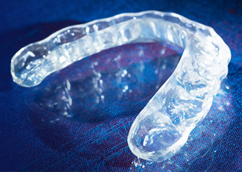 TMJ Treatment Splint / TMJ Splint - Burbank Dental Lab - Burbank, CA