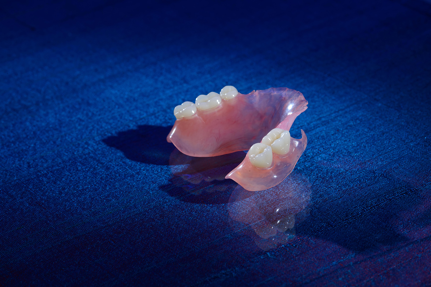 Valplast Partial Denture - Burbank Dental Lab - CA