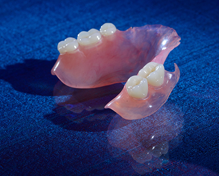 Valplast Partial Denture - Burbank Dental Lab - CA