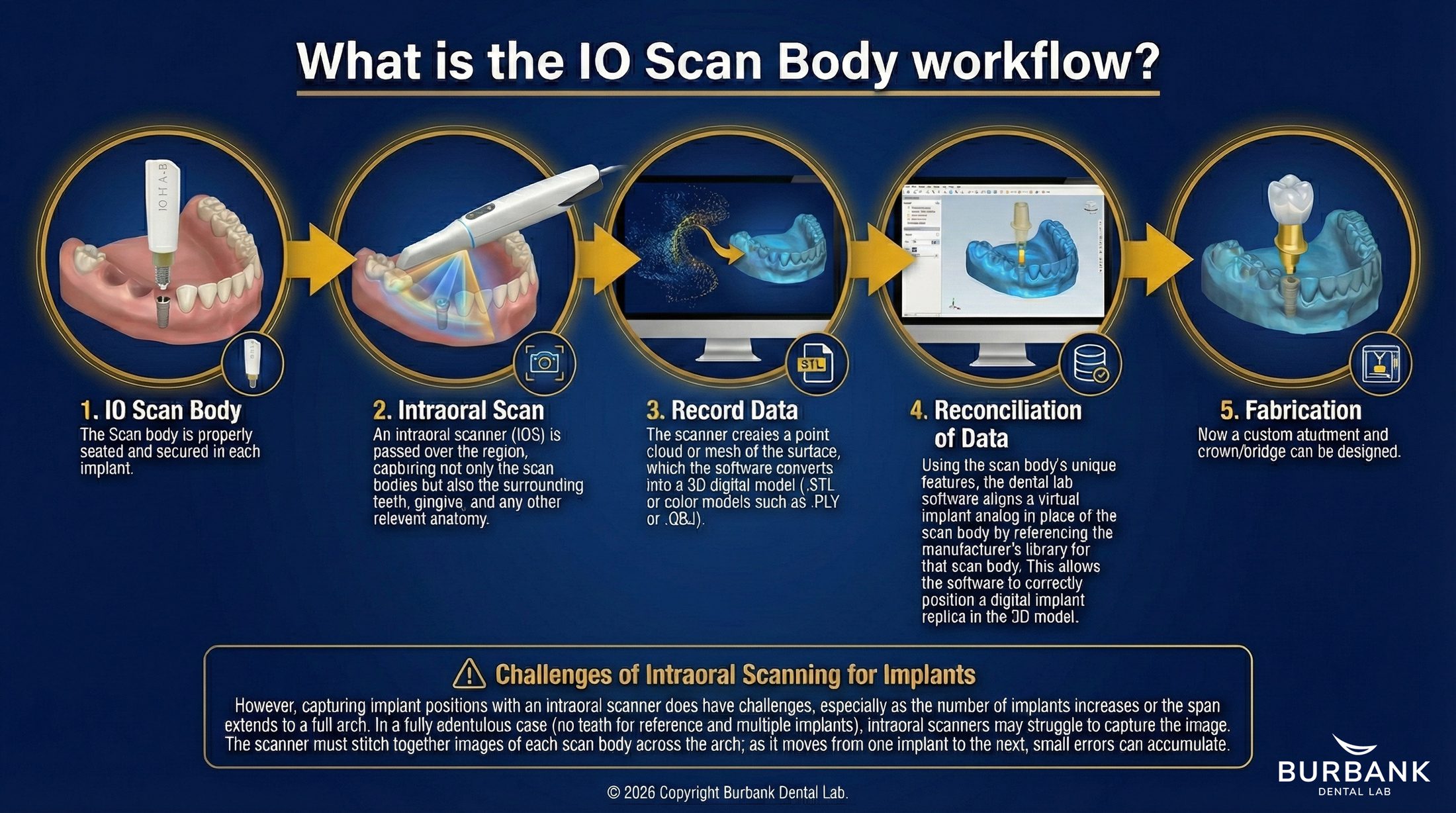 What is the IO Scan Body Workflow? - Burbank Dental Lab