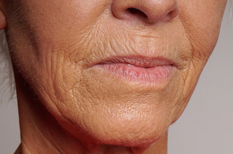 Ivoclar PrograMill - Burbank Dental Lab