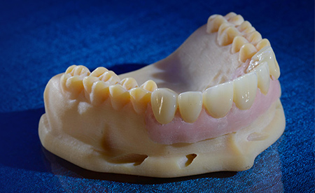 Zirconia vs. Lithium Disilicate: How to Choose the Right Crown Material | by Andrew Sedler, COO | Burbank Dental Lab