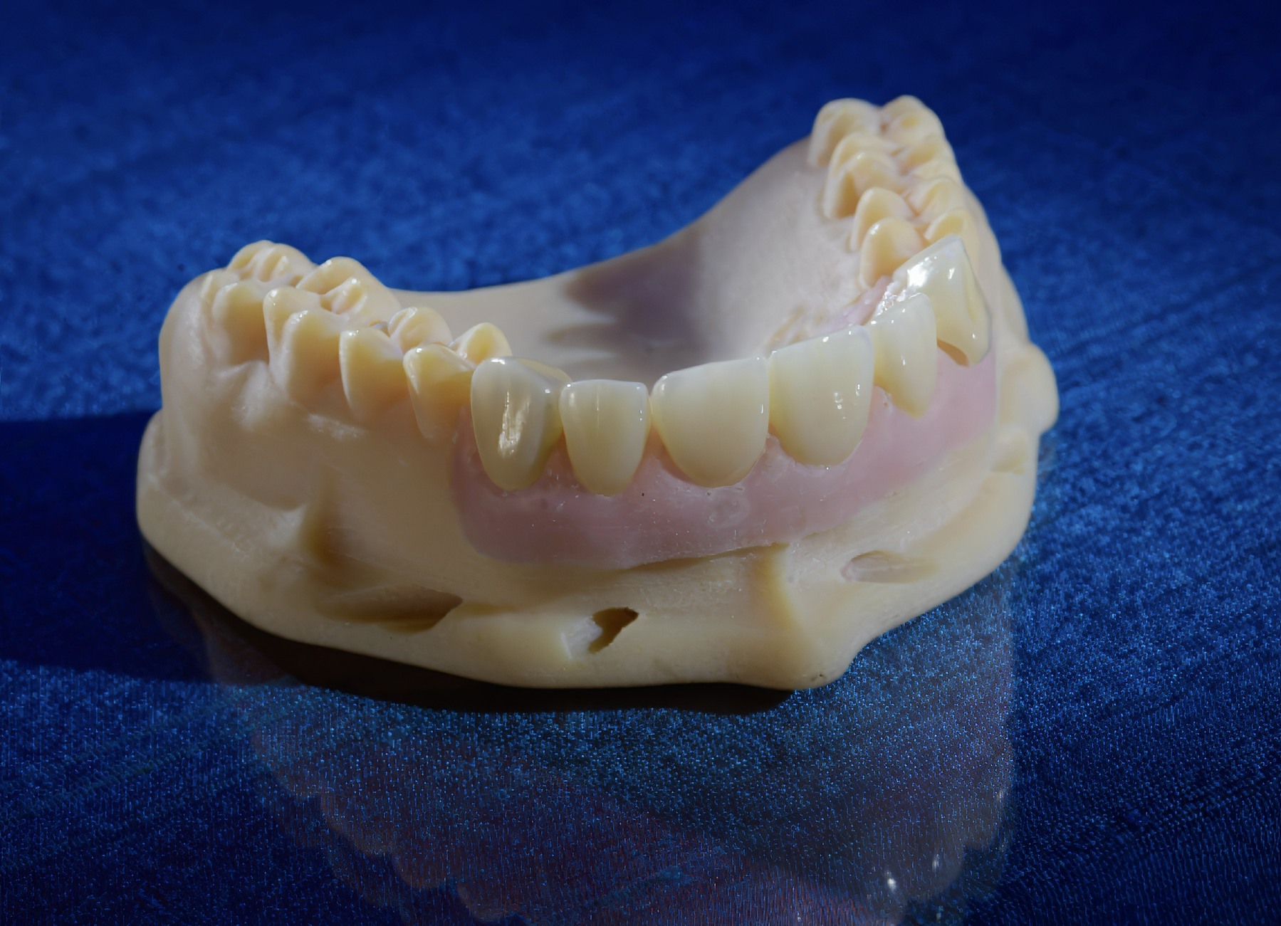 Zirconia vs. Lithium Disilicate: How to Choose the Right Crown Material | by Andrew Sedler, COO | Burbank Dental Lab