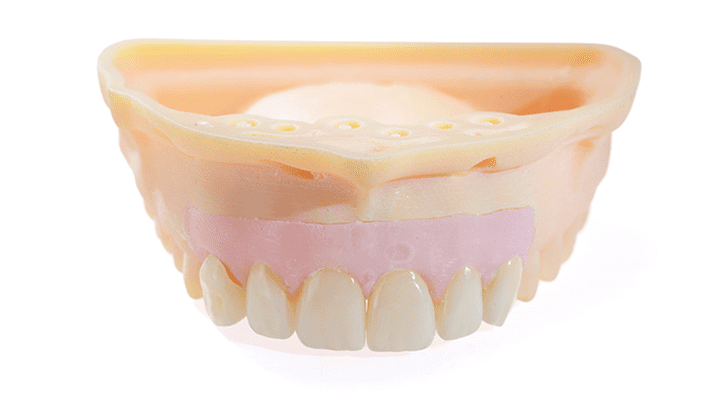 Multi-Unit Abutments: When and How To Use Them